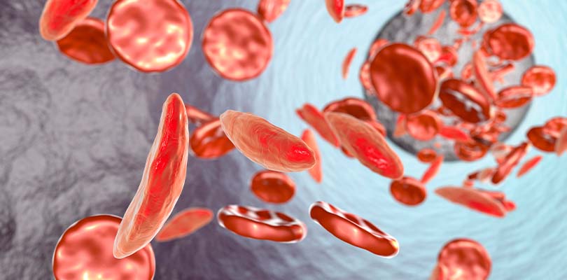 A graphic of red blood cells floating in a human's body.